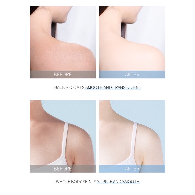 Kem Tẩy Tế Bào Chết Fenyi Làm Sạch Sâu Cho Cơ Thể