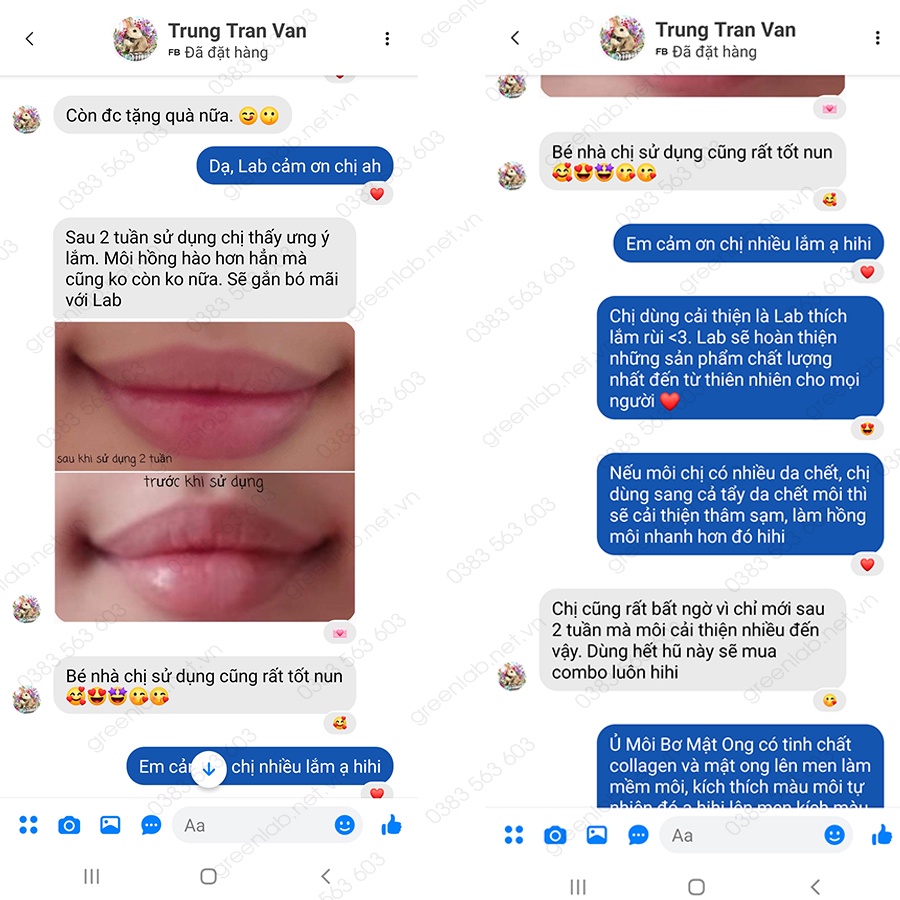 Ủ Dưỡng Môi Bơ Mật Ong GreenLab. Môi mềm mịn, hết khô hết nẻ mang đến môi hồng tự nhiên hũ 8g