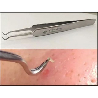 [Hàng đẹp] Nhíp gắp mụn thần thánh của Hàn Quốc
