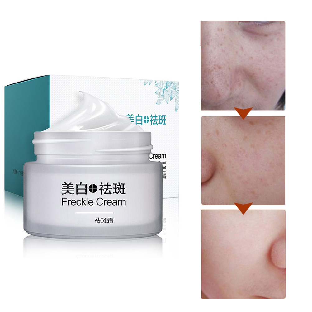 COD 30g Whitening Cream Anti Freckle Face Cream Moisturizing Anti Pigmentation Reduce Age Spots Fade Dark Spot Face Cream