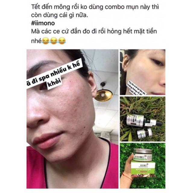 Combo 3 hộp tinh chất mụn IIMONO 6ml | BigBuy360 - bigbuy360.vn