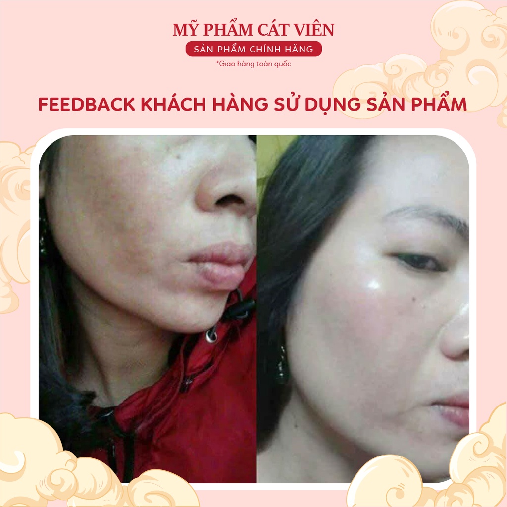 Tế Bào Gốc Melatox Medicell, Serum Giảm Nám Dưỡng Da Chính Hãng, Tái Tạo Da - Lọ 6ml