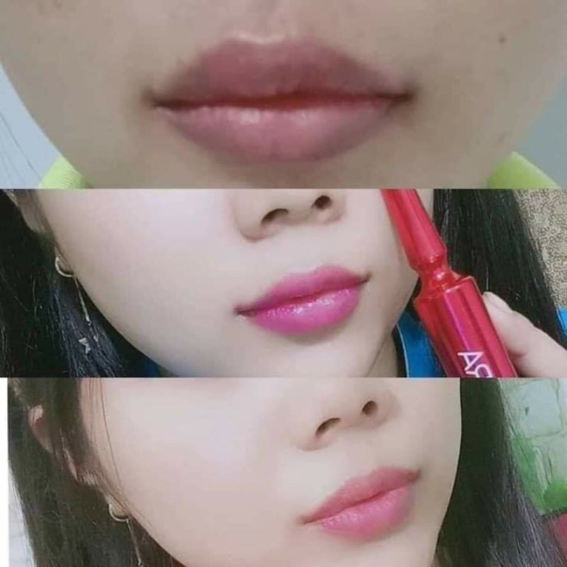 Tinh chất hồng môi vaura hàn quốc -loại bỏ thâm môi, nứt nẻ, khô môi, thay phun xăm...