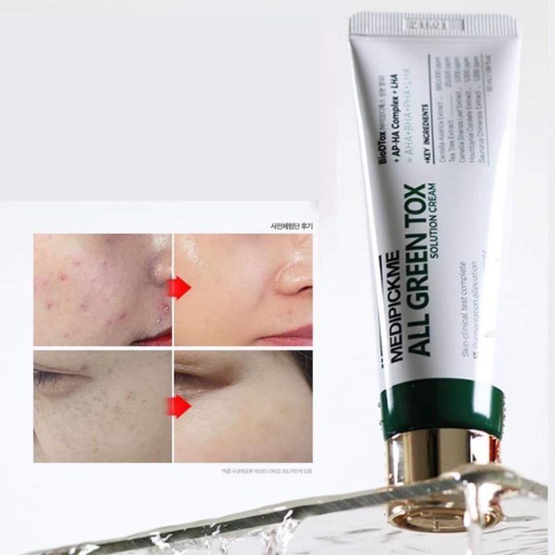 Kem dưỡng All Green Tox Solution của MEDIPICKME 50ML
