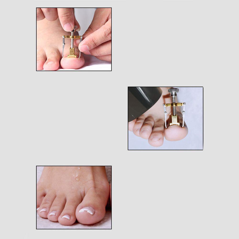 MOCHO Dụng Cụ Chỉnh Hình Móng Chân Mọc Ngược Chuyên Nghiệp Bằng Thép Không Gỉ