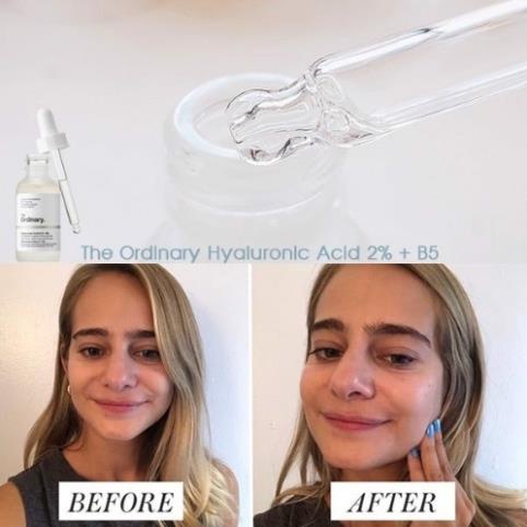Tinh Chất Cấp Nước Phục Hồi Da Serum THE ORDINARY Hyaluronic Acid 2% + B5 - Hàng Chính Hãng | BigBuy360 - bigbuy360.vn