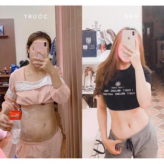 KEM TAN MỠ BỤNG MISSHA HOT BURNING