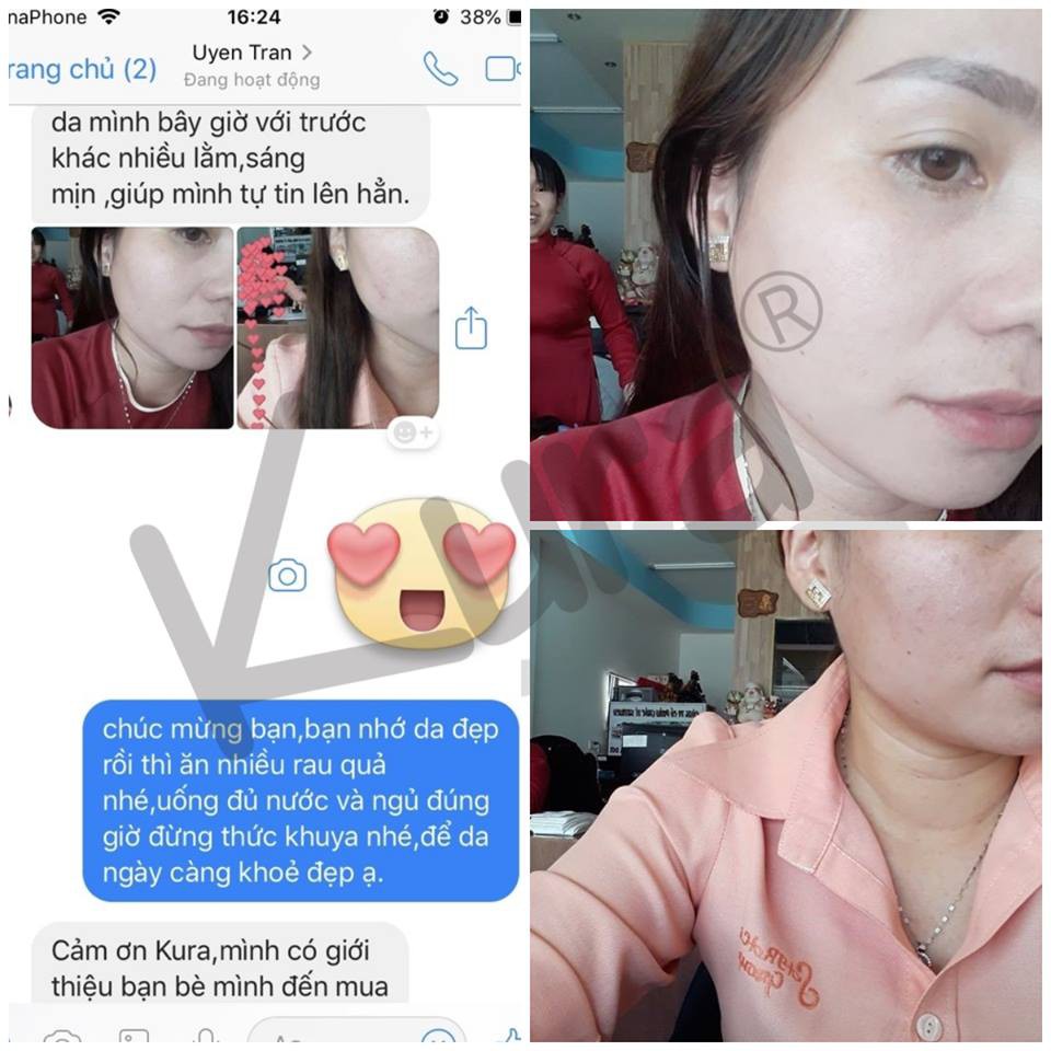 Kem Dưỡng Da Cao Cấp - Kura Beauty Face (3in1) | BigBuy360 - bigbuy360.vn