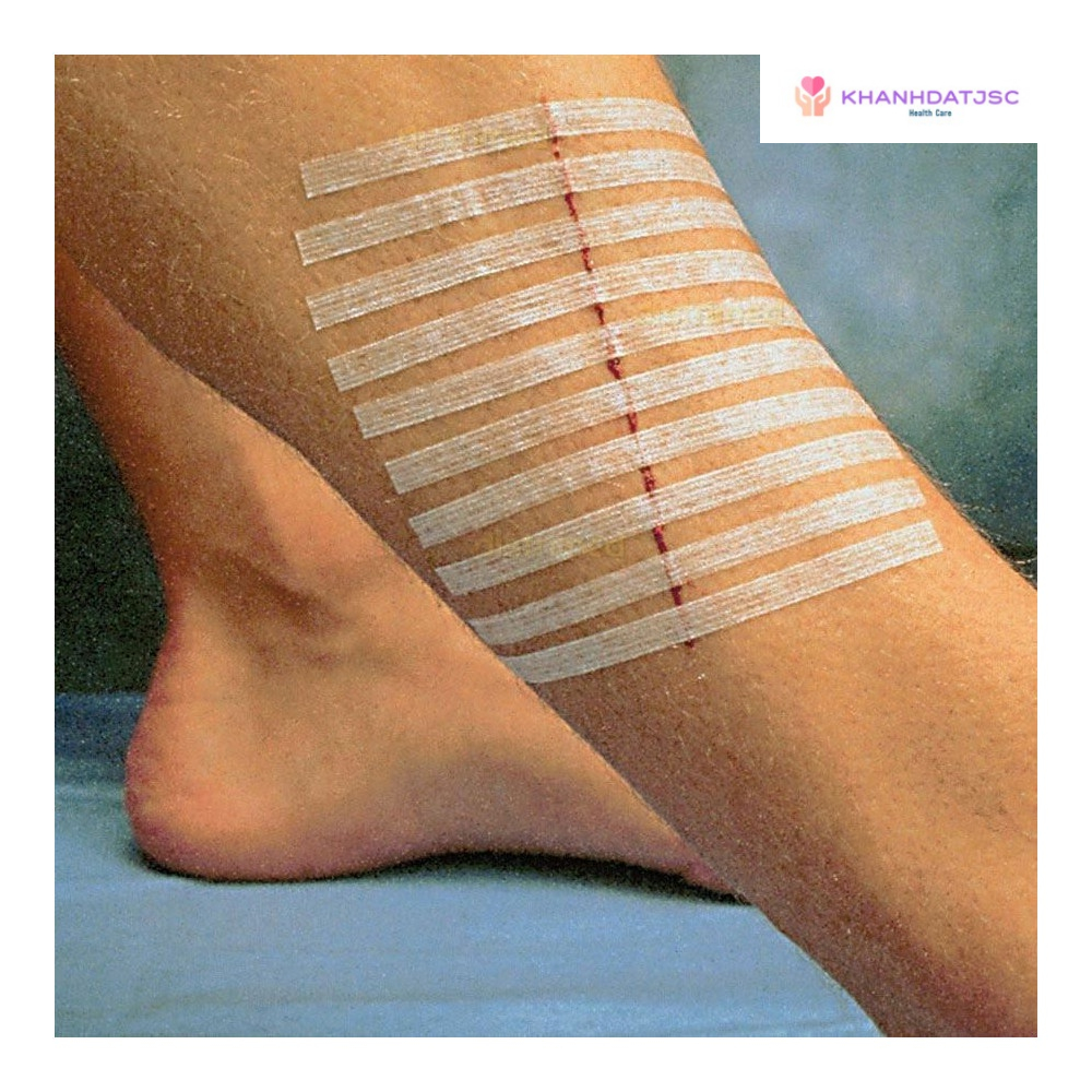 Băng vô trùng thay chỉ khâu Urgostrips 100mm x 6mm