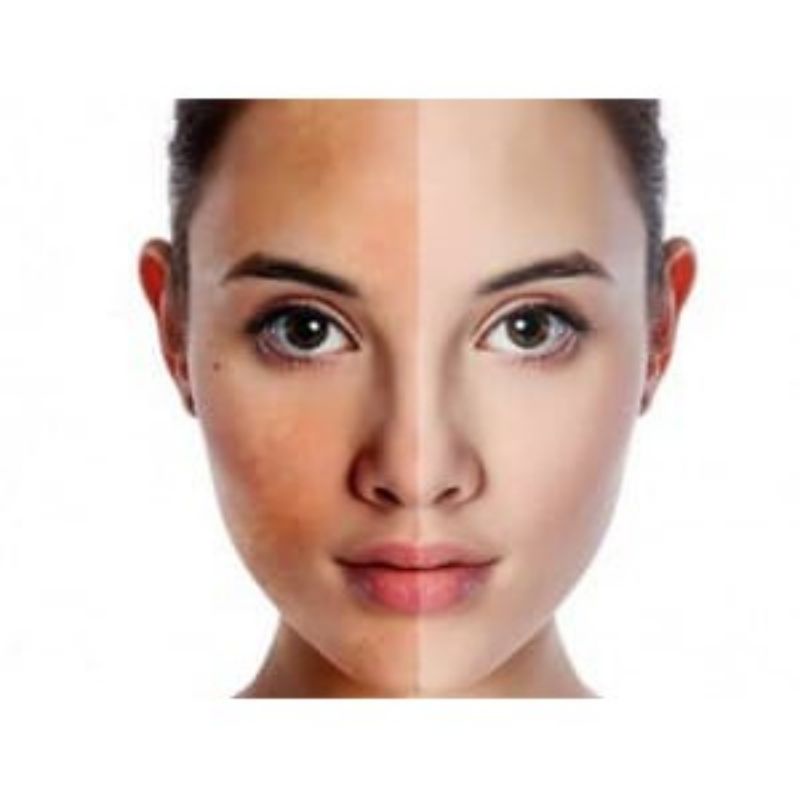 Viên sủi trắng da mờ nám Bora White cam kết chính hãng.-873