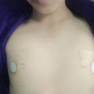 Keo dán ngực  3M Transpore