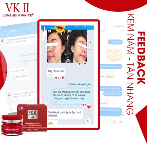 Kem dưỡng da mờ nám, tàn nhang, đồi mồi VK II Love Skin White Face Cream Collagen 20g