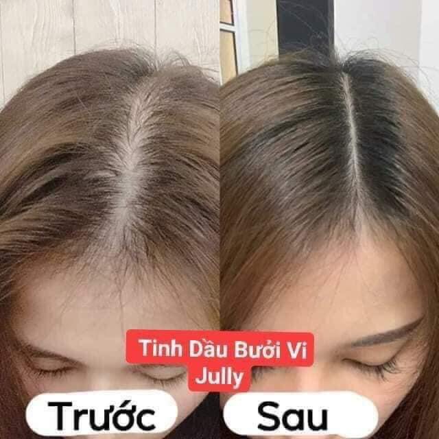 Tinh dầu bưởi Vijully giảm rụng tóc, kích tóc mọc nhanh | BigBuy360 - bigbuy360.vn