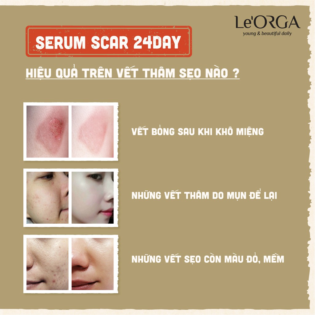Serum Hết Thâm Le'Orga - Scar 24day Tinh Chất Mờ Thâm Mụn Huyết Thanh Liền Sẹo Tái Tạo Trắng Da | BigBuy360 - bigbuy360.vn