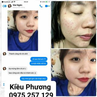 SERUM THẢO DƯỢC THIÊN NHIÊN NGỌC LINH SÂM