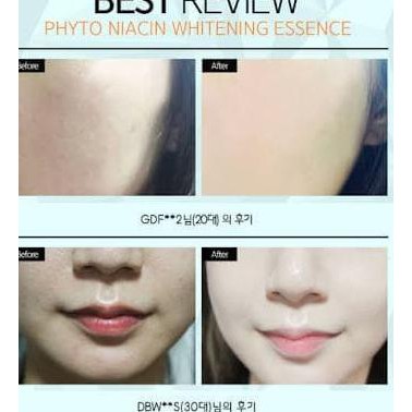 ✰ Tinh Chất Làm Trắng Da Tự Nhiên PACIFIC Phyto Niacin 50ml (100% Gốc) ♝