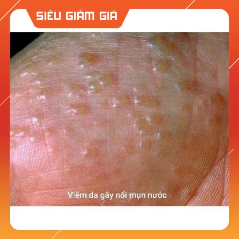Kem bôi da kem bôi tổ đỉa ghẻ nước nấm ngứa các loại, thảo dược tự nhiên