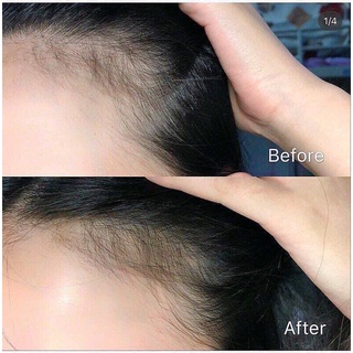 TINH CHẤT KÍCH THÍCH MỌC TÓC SATO AROVICS SOLUTIONS 5% 30ML