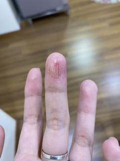 Liquid Bandage - băng cá nhân dạng nước