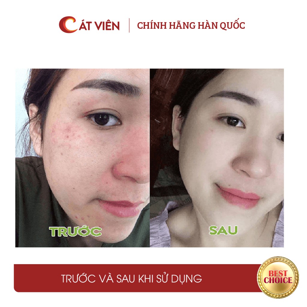 Tế bào gốc, serum kiềm dầu, cải thiện mụn, sẹo mụn, làm trắng Plantex Saffron Medicell Hàn Quốc hộp 10 lọ