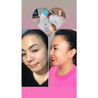 Sữa Rửa Mặt LUMISPA - Dành Cho Máy Rửa Mặt LumiSpa