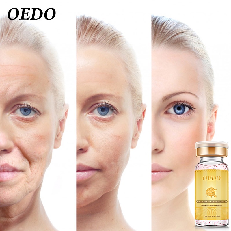 Set mỹ phẫm OEDO gồm sữa rửa mặt Amino Acid làm sạch sâu+kem dưỡng ẩm chống nếp nhăn+tinh chất thu nhỏ lỗ chân lông