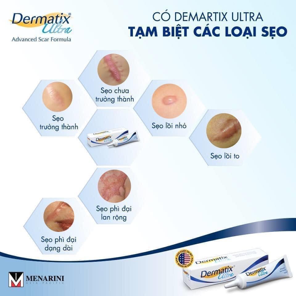 Kem giảm sẹo Dermatix Ultra 7g - Gel hỗ trợ làm lành sẹo hiệu quả - cvspharmacy