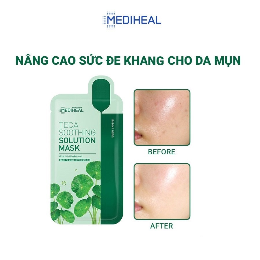 Mặt Nạ Chuyên Sâu Cao Cấp Dành Cho Da Mụn Mediheal Solution Mask 21ml - Teca Soothing