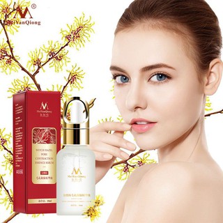 Serum Hết Mụn Se Khích Lỗ Chân Lông Trắng Da