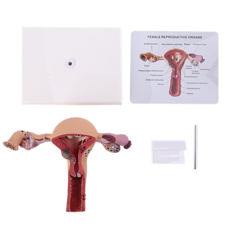 Mô Hình Lối Đi Bệnh tật Bằng Tiếng Ồn Người Phụ Nữ Uterus