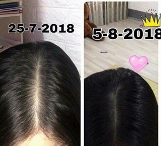 Combo tinh dầu bưởi pomelo và gel mi coco
