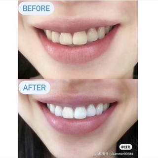 [Hàng bay air Mỹ] Kem đánh răng Crest 158g
