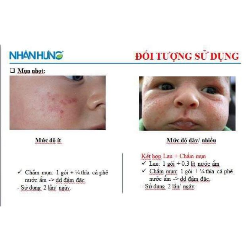 Bột tắm trẻ em Nhân Hưng hàng chính hãng