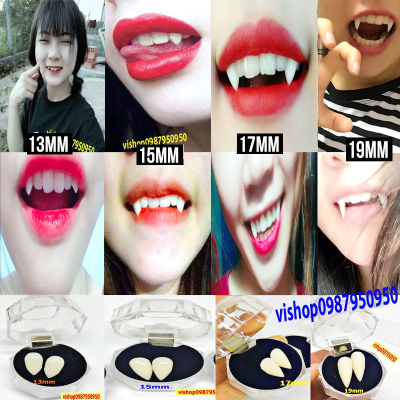 RĂNG KHỂNH GIẢ LOẠI ĐẸP TỰ NHIÊN