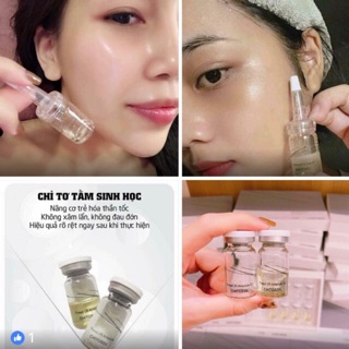 Chitossil - cấy chỉ tơ tằm - chỉ cần bôi mà lại đẹp như căng chỉ