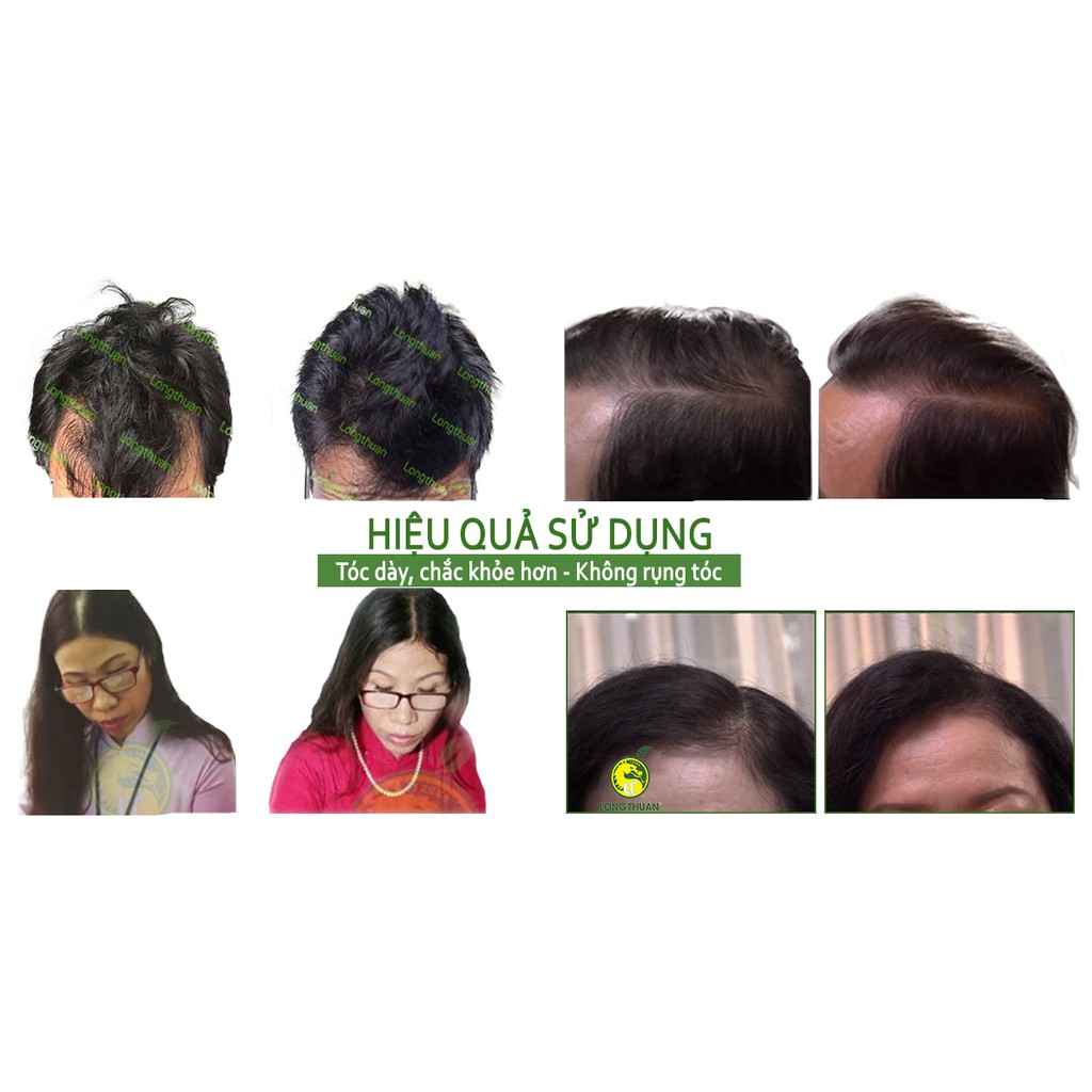 Tinh Dầu Hoa Bưởi Loại 2 - Trị Hói Đầu - Rụng Tóc - Kích Thíc Mọc Tóc | BigBuy360 - bigbuy360.vn