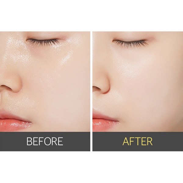 Nước Hoa Hồng Cho Da Mụn,Da Dầu - Toner Med Xanh | BigBuy360 - bigbuy360.vn