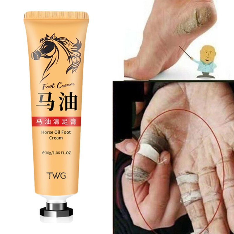 Kem Dầu Ngựa Dưỡng Da Chân 30g Loại Bỏ Vết Chai Sần Chống Khô Da