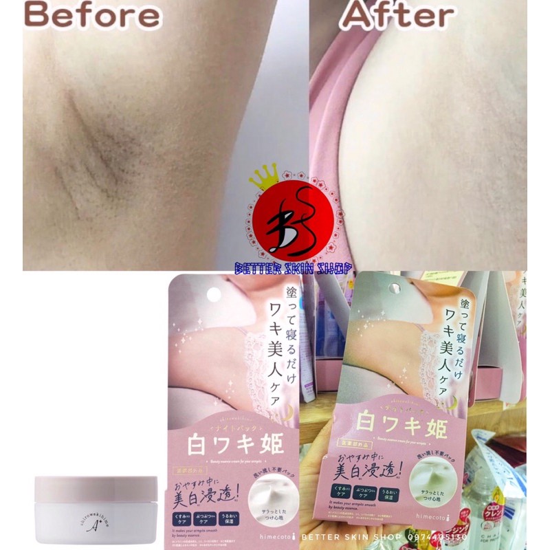 Kem dưỡng trắng nách Himecoto - giảm thâm nách ban đêm Himecoto 18ml Nhật Bản