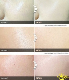 Phấn nén Karadium Collagen Smart Sun Pact