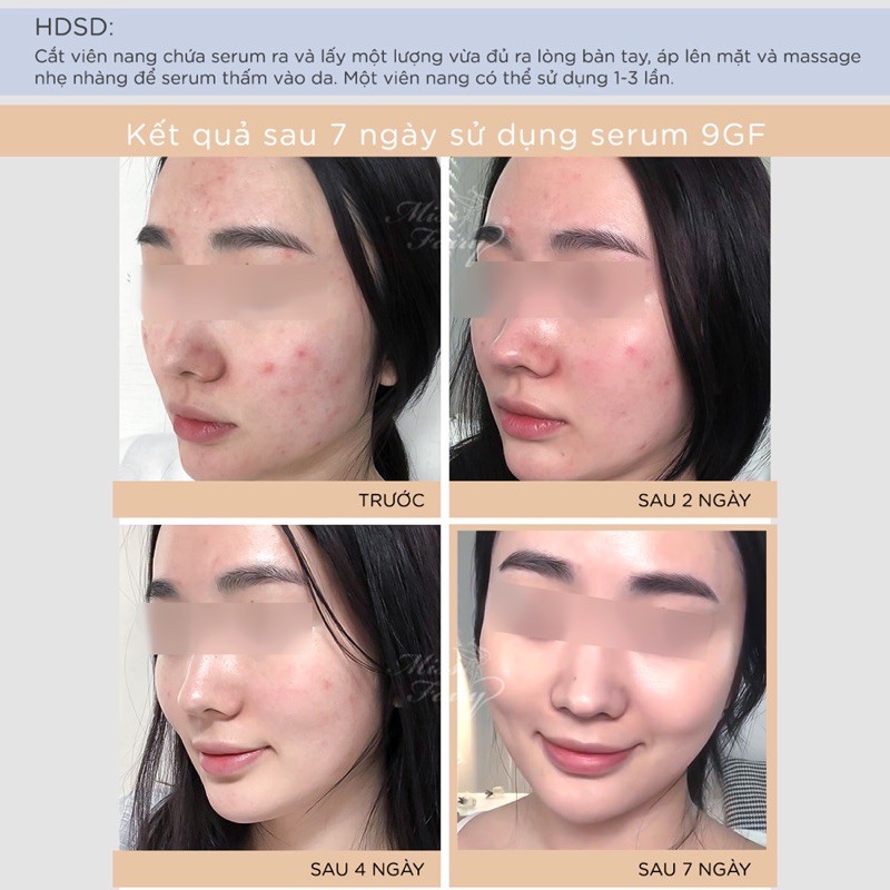 Serum MISS FAIRY 9GF 30v - Phục Hồi - Tái Tạo - Thải Độc Chì - Cân Bằng Độ pH - Làm Trắng Sáng - Căng Bóng Da