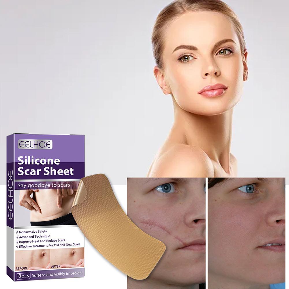 Bộ 8 Miếng Dán Silicone Hỗ trợ giảm sẹo Làm Sáng Tông Màu Da Q2T4