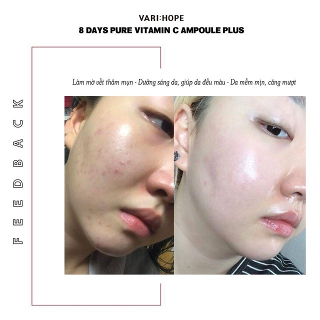 Tinh chất dưỡng trắng da ngày và đêm Image Beauty Hexapeptide 30ml