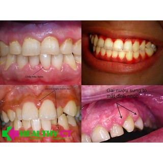 Chấm răng Eupolin - Học Viện Quân Y Lọ 15g