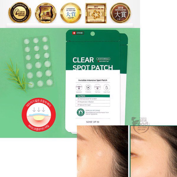 Miếng Dán Giảm Mụn &quot;Thần Kỳ' Some By Mi Clear Spot Patch (Set 18 miếng)