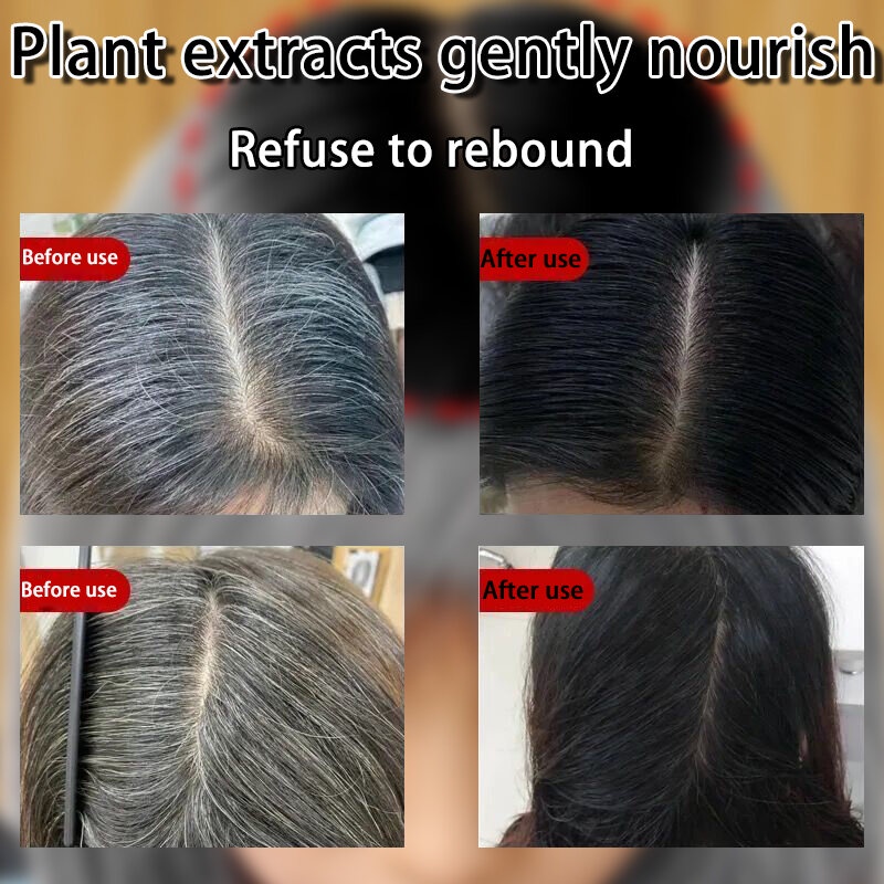 Tinh chất đen tóc Dầu dưỡng tóc ủ tóc phục hồi hư tổn serum dưỡng tóc dầu xả tóc Xịt tóc đen xịt mọc tóc 100ml