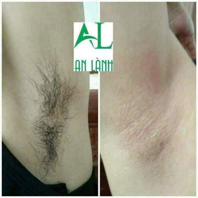 COLD WAX AN LÀNH - WAX LÔNG SẠCH TẬN GỐC