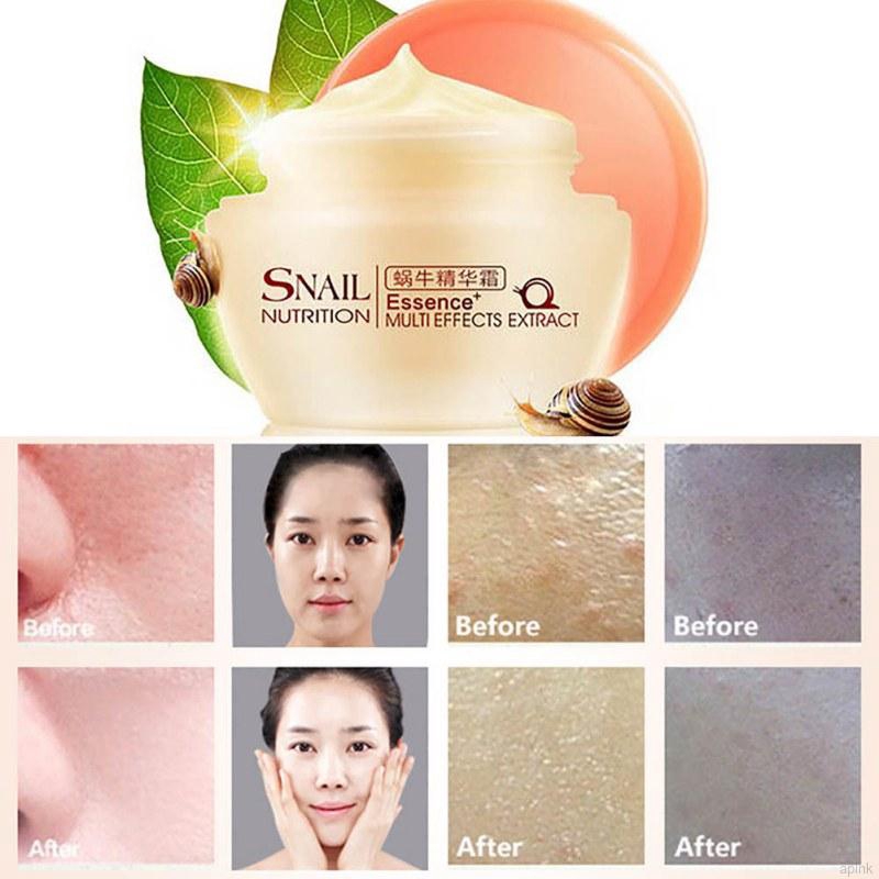 Kem dưỡng da tinh chất ốc sên LAIKOU dưỡng ẩm làm trắng da chống nếp nhăn 50g