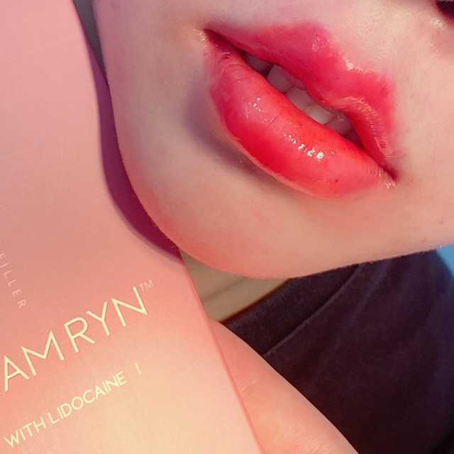 Chất làm đầy chamryn HA an toàn