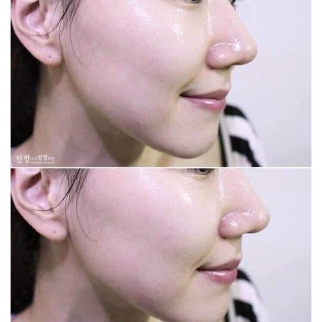 Tinh chất Serum Vitamin C Esthemax 561 Sáng Da, hỗ trợ Thâm Mụn, Đều Màu Da 100ml